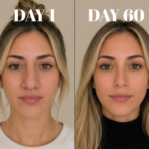 Nu Mayfair Facial Refinement Device