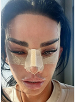 Rhinoplasty